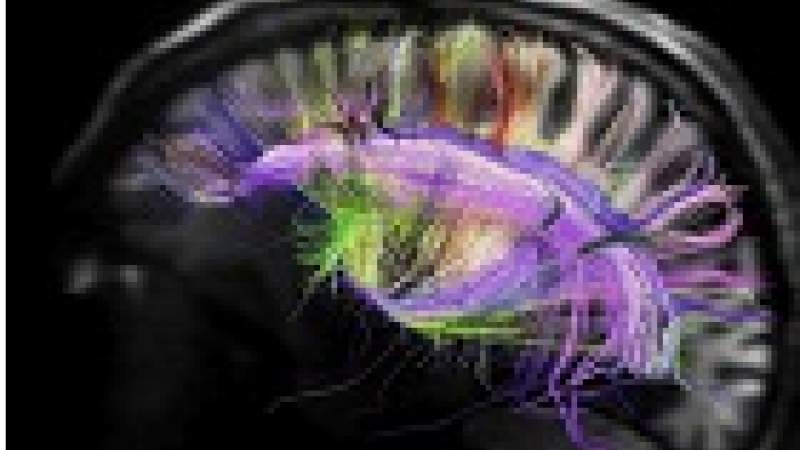 تلوث الهواء يسرّع شيخوخة الدماغ